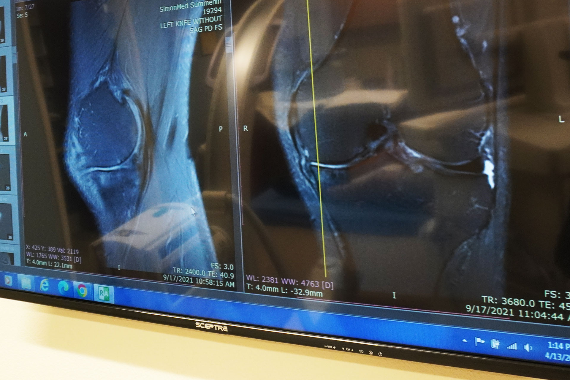 Stem Cell Treatment Near Me